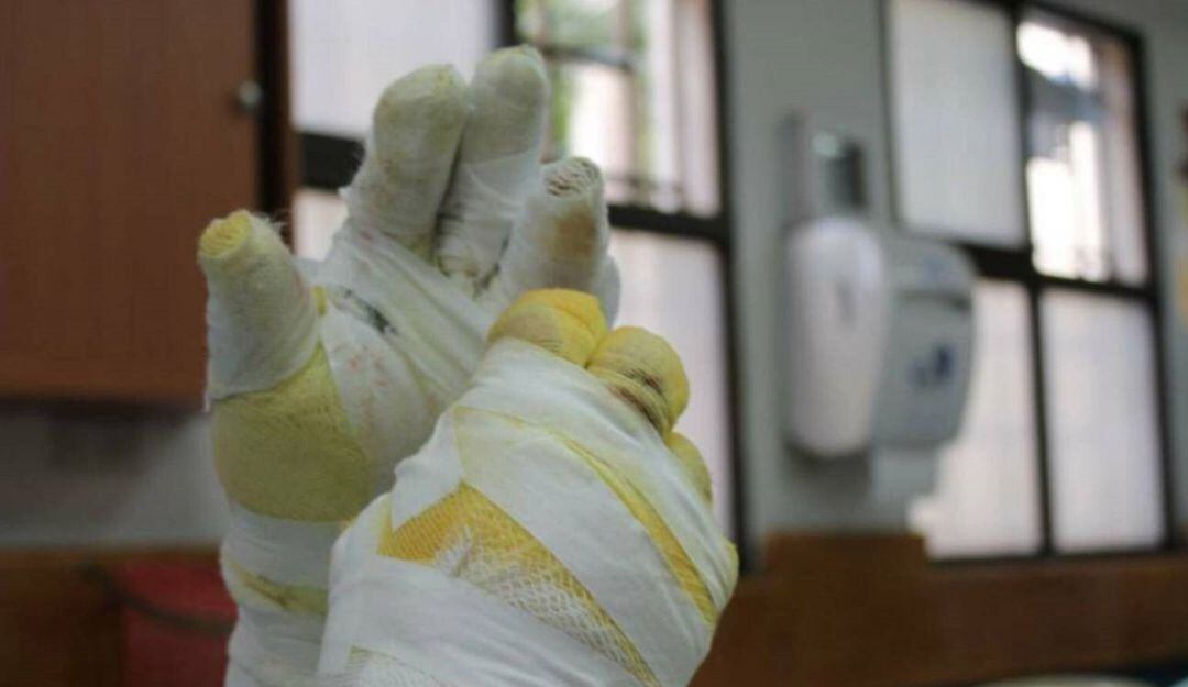 Quemados por pólvora