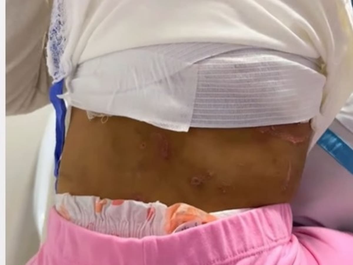 Pareja que tenía custodia del ICBF, a la cárcel por presunto abuso y maltrato a niña de dos años