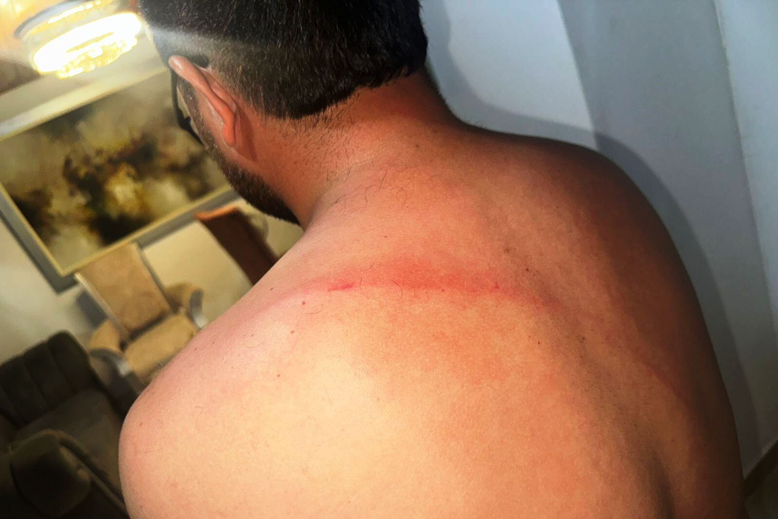Brigadista de la Gerencia de Espacio Público fue golpeado por un comerciante informal