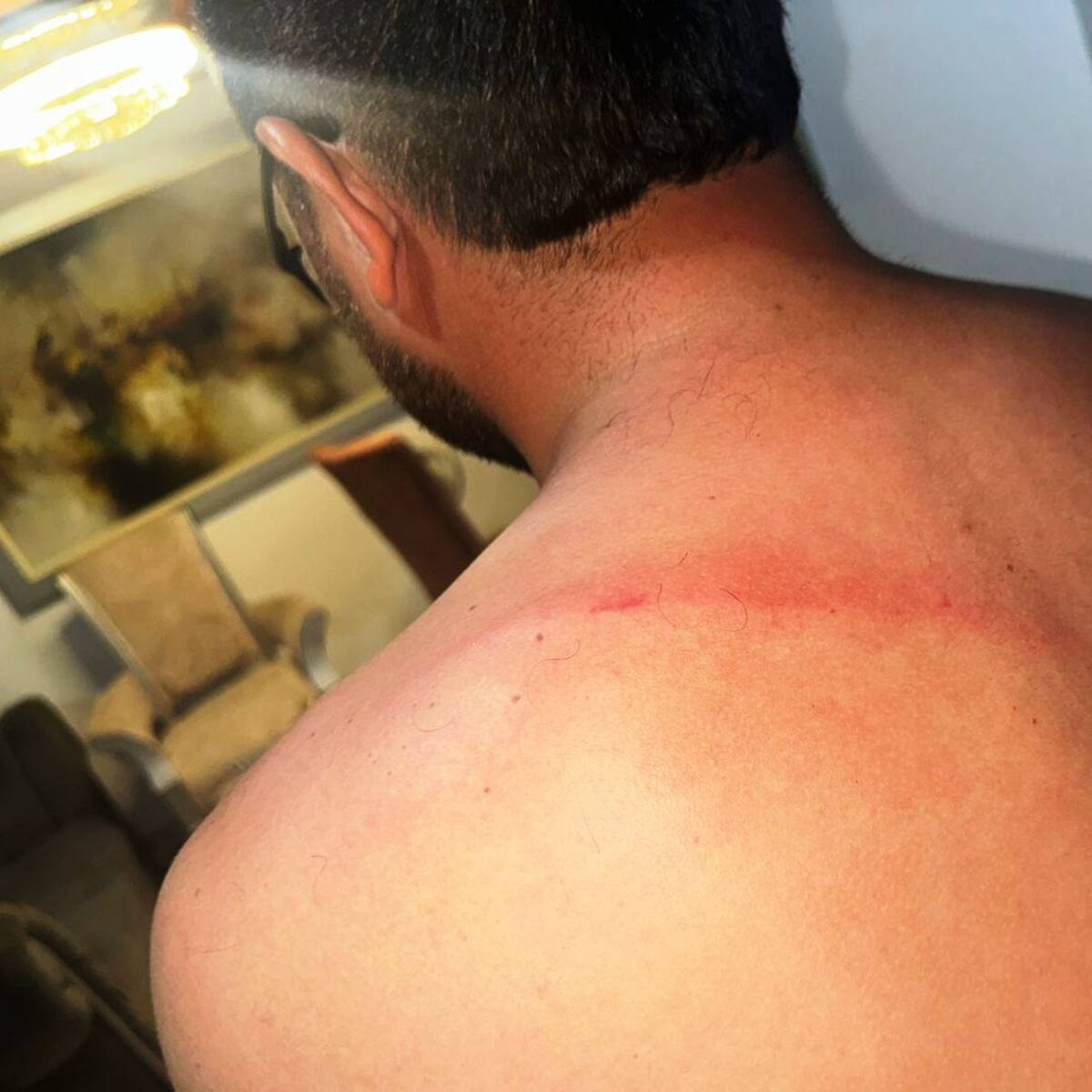 Brigadista de la Gerencia de Espacio Público fue golpeado por un comerciante informal
