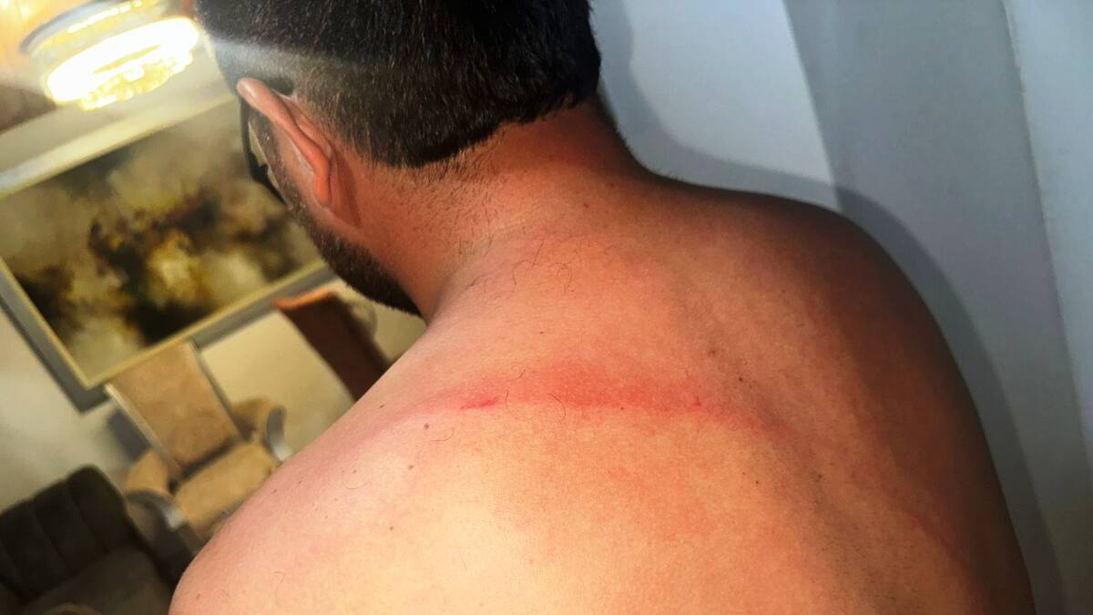 Brigadista de la Gerencia de Espacio Público fue golpeado por un comerciante informal