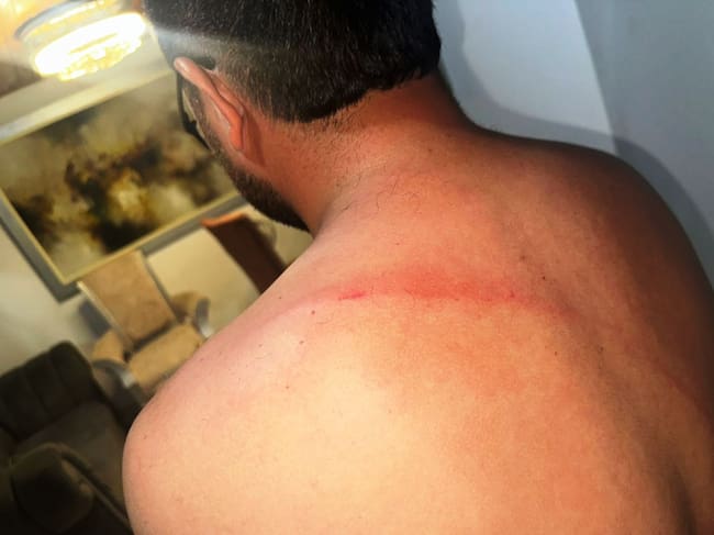 Brigadista de la Gerencia de Espacio Público fue golpeado por un comerciante informal