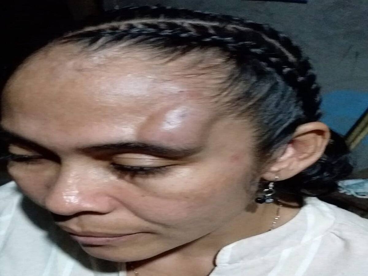 Policías habrían agredido a líder social en Tierralta, denuncia Cordoberxia