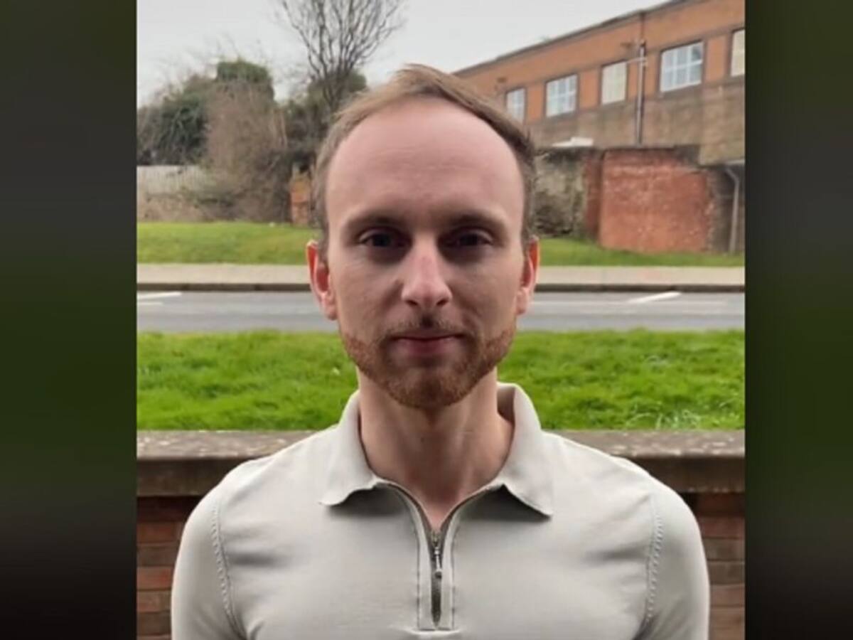 Impactado: Joven calvo llora tras verse con un implante capilar