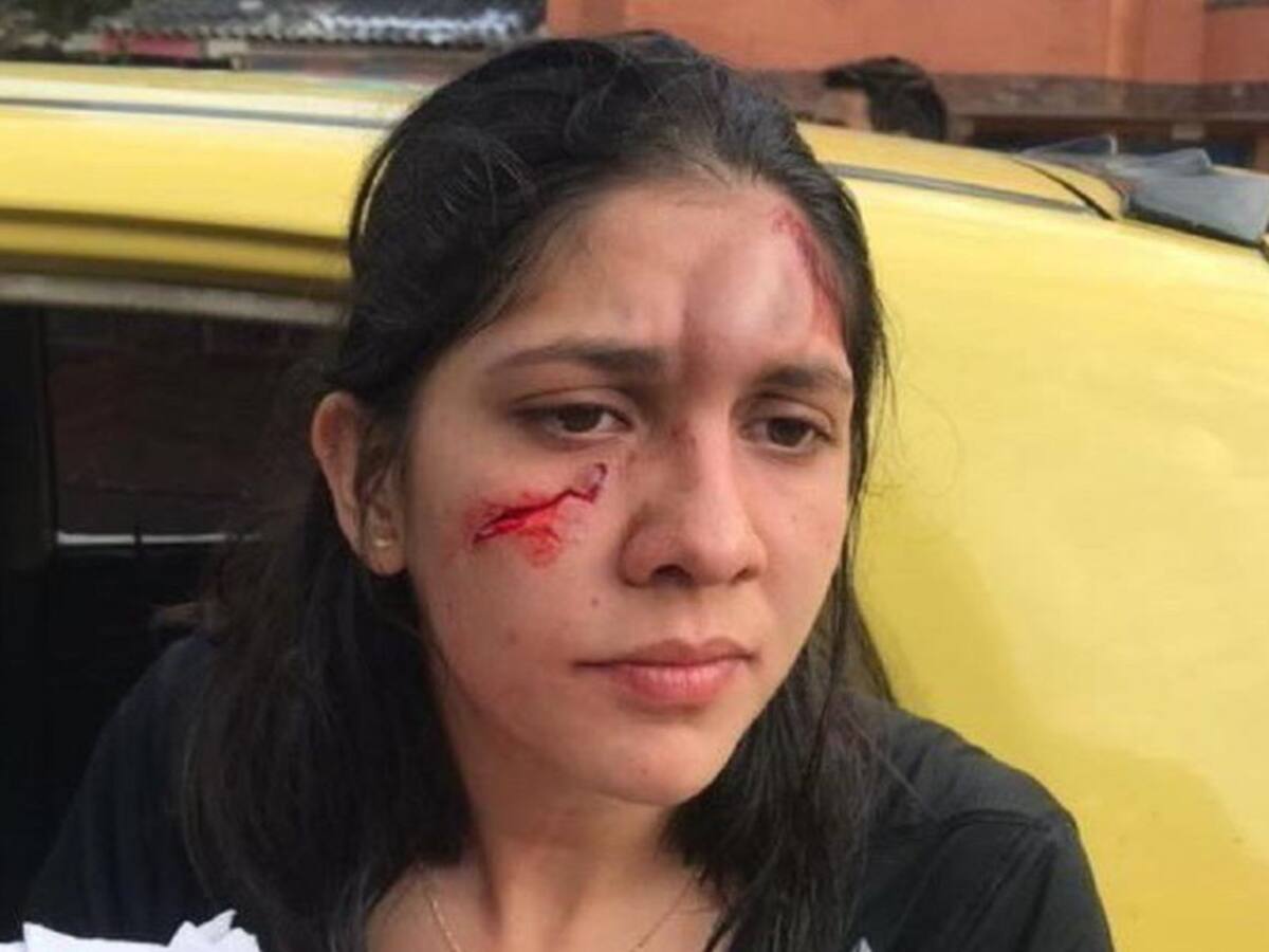 Víctima de agresión en La Victoria recibe acompañamiento psicosocial