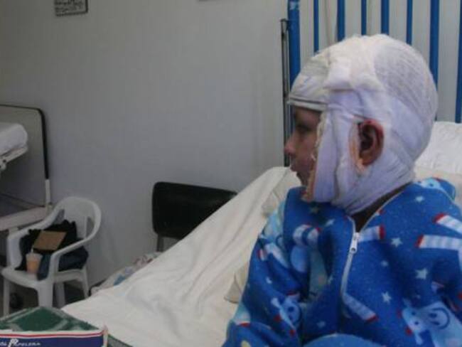 ICBF verificará la situación de 42 niños quemados con pólvora