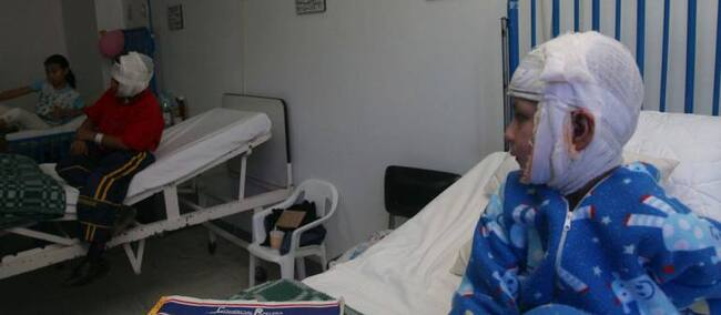 Quemados con polvora.