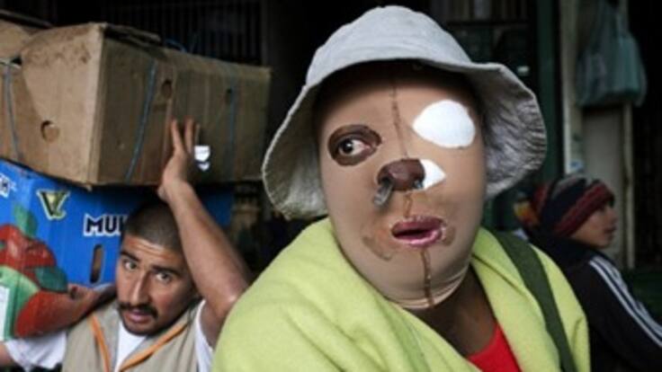 Daily Mail alerta por aumento de casos de mujeres quemadas con ácido en Colombia