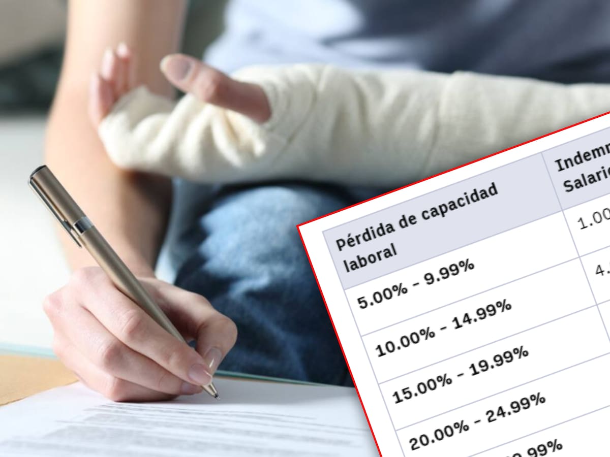 Tabla de indemnizaciones por pérdida de capacidad laboral 2026: Porcentaje según lesión