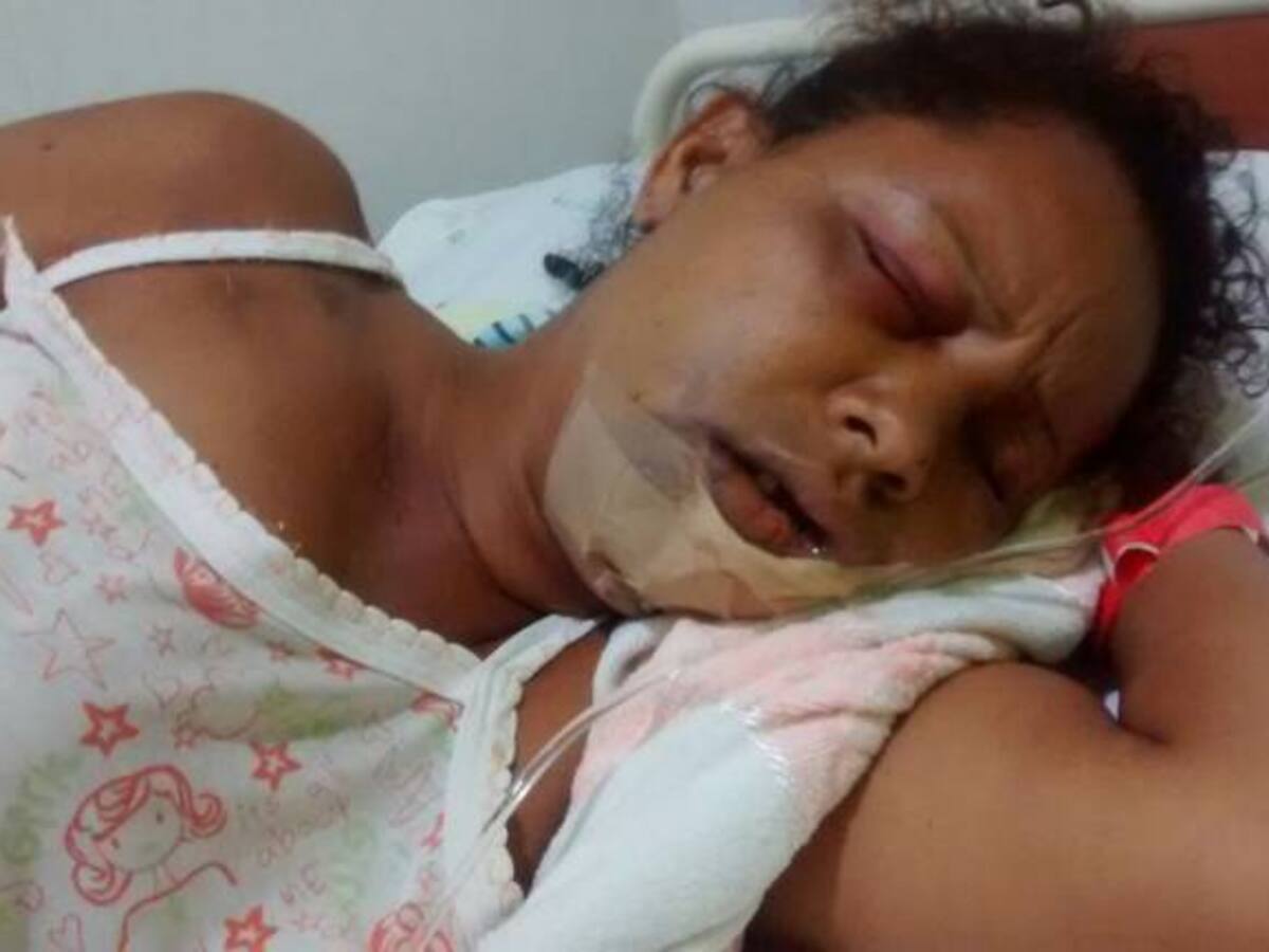 En brutal ataque hombre le saca los dientes a su compañera con una pinza