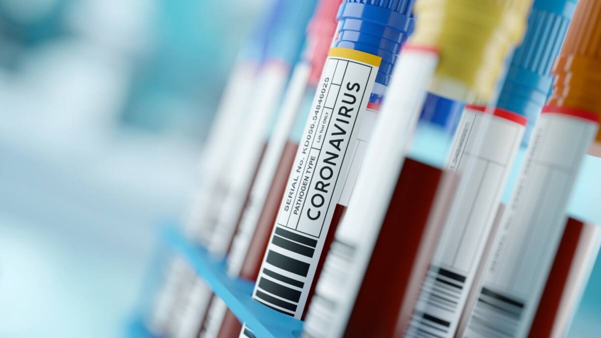 Boyacá sobrepasó los 3.000 contagiados por coronavirus