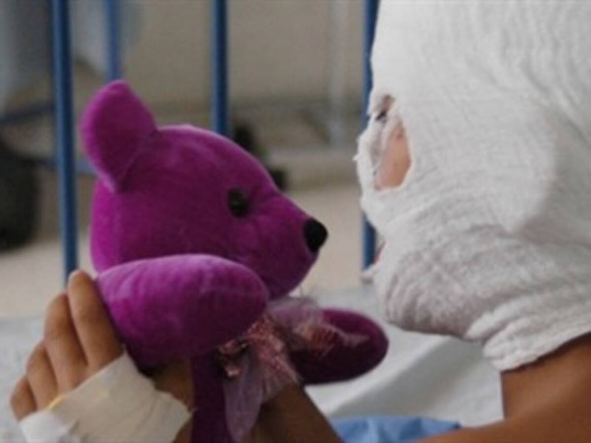 31 quemados con pólvora durante la Navidad, reportan las autoridades