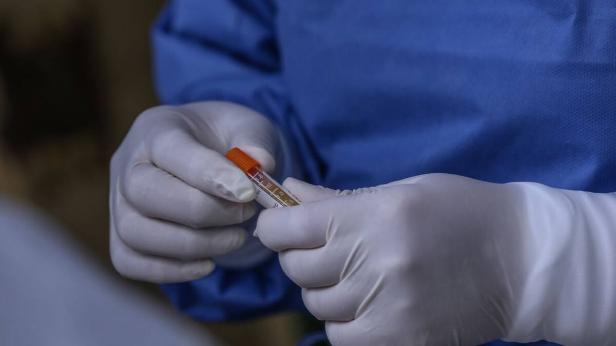 Qué es el 'COVID incidental' y qué implica en la cifra de contagios