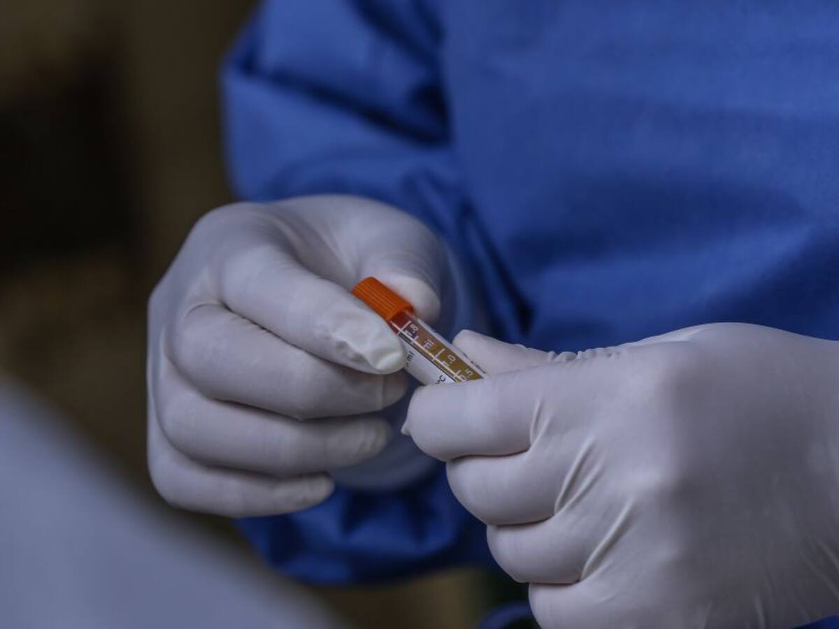 COVID-19 en Colombia: 31.170 nuevos casos y 38 fallecidos