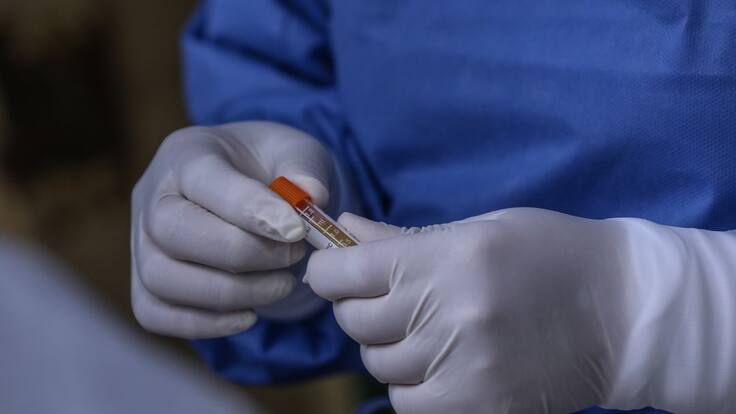 Qué es el 'COVID incidental' y qué implica en la cifra de contagios