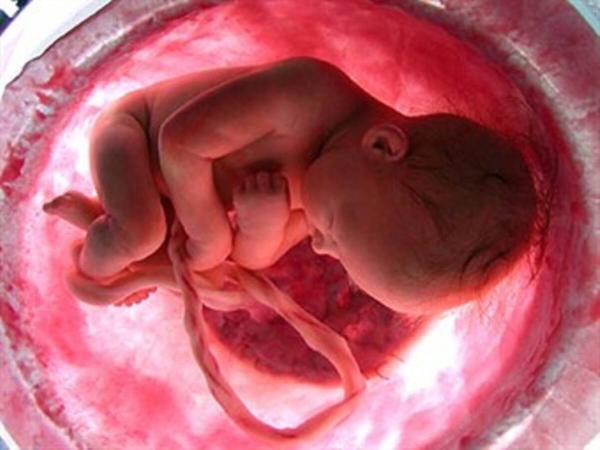 Supersalud no revocará circular del aborto pese a más de 1.200 derechos de petición