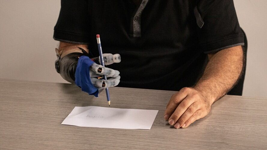 Desarrollan en Colombia prótesis bioinspirada para pacientes de escasos recursos. Foto: Escuela Colombiana de Ingeniería Julio Garavito