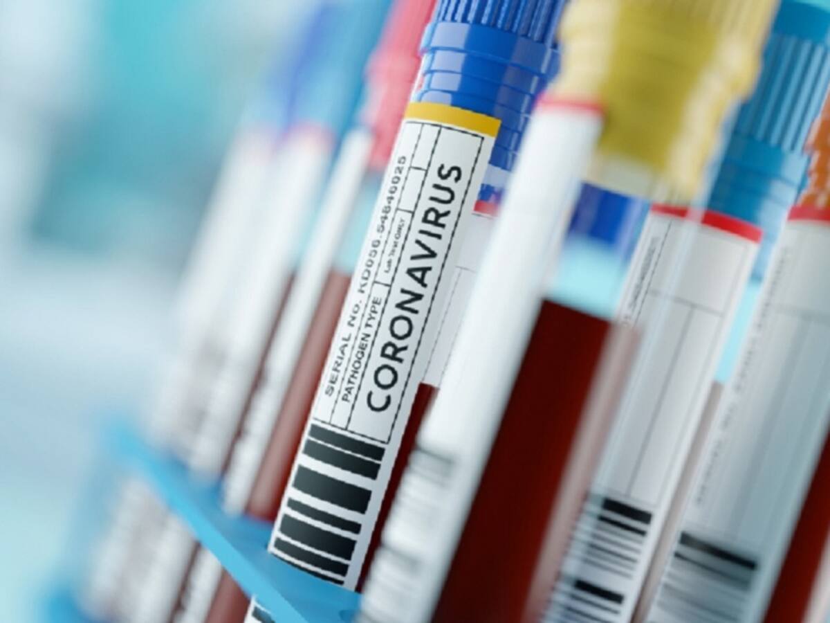 Tres nuevos casos de Coronavirus en Norte de Santander