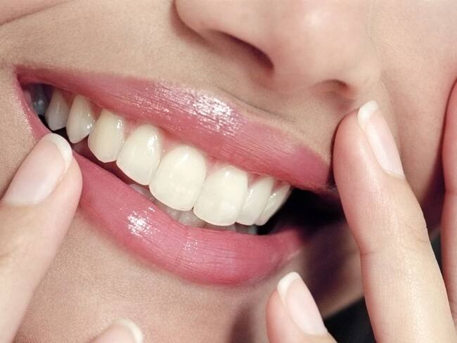 Consecuencias en los dientes al consumir en exceso alimentos ácidos