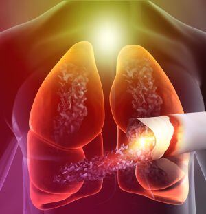 El costo mundial del cáncer se estima en cerca de 1,16 billones de dólares (WCD, 2021)