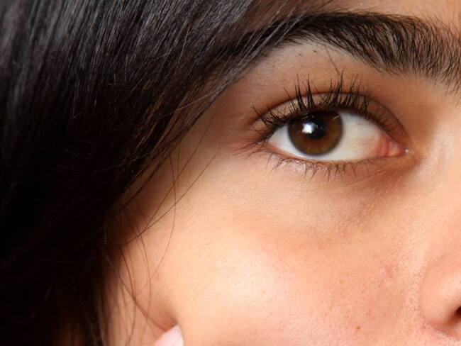 El carrusel que viven los jóvenes con acné en busca de tratamiento