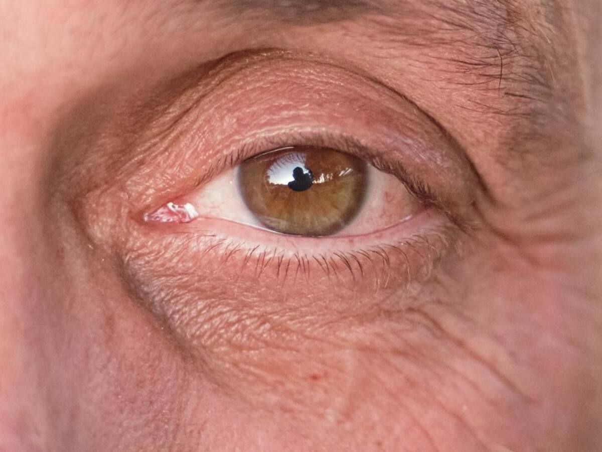 Covid-19 podría afectar la salud visual según un reciente estudio