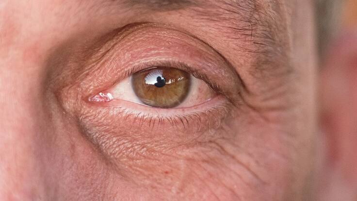 Experto habla sobre los efectos en la córnea que puede acarrear una persona luego del contagio por Covid-19