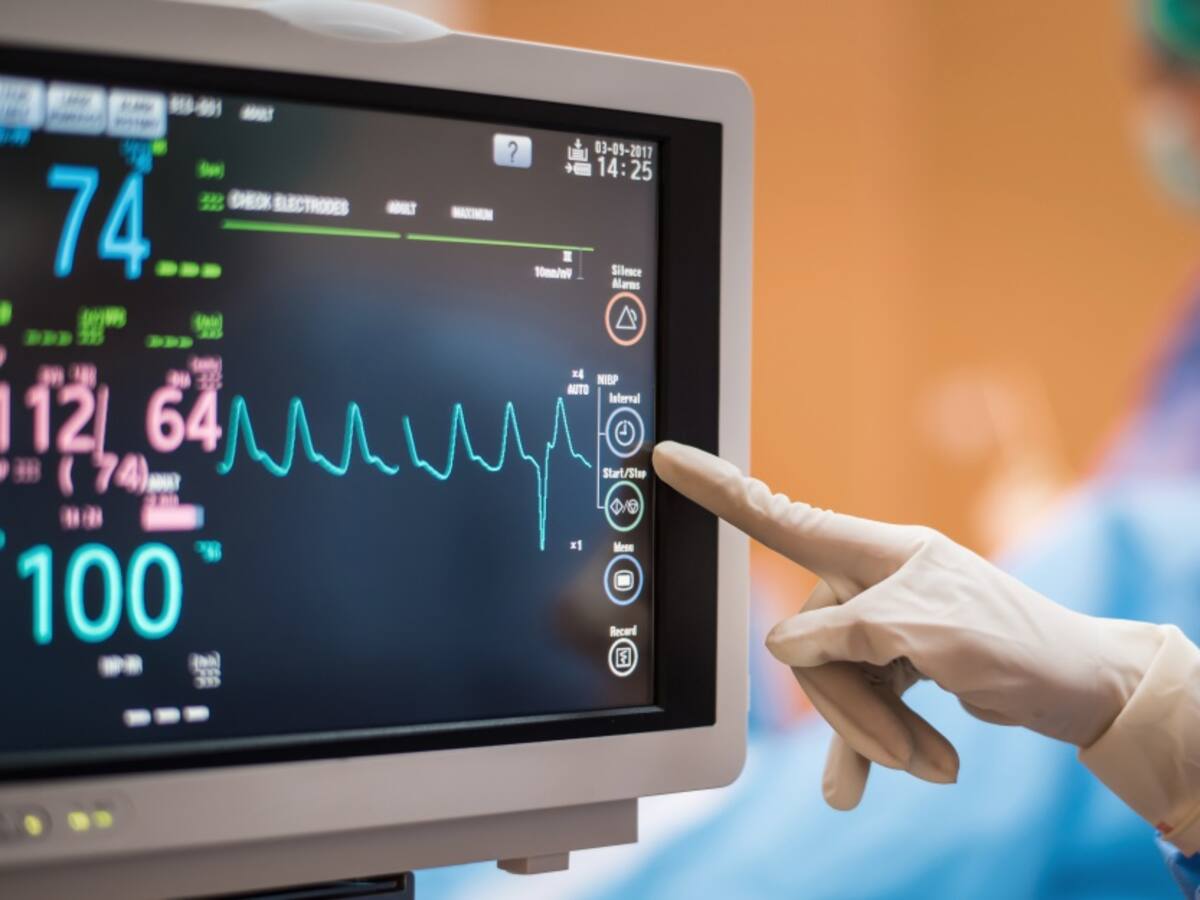 Más del 78% de los episodios de arritmia cardiaca son asintomáticos