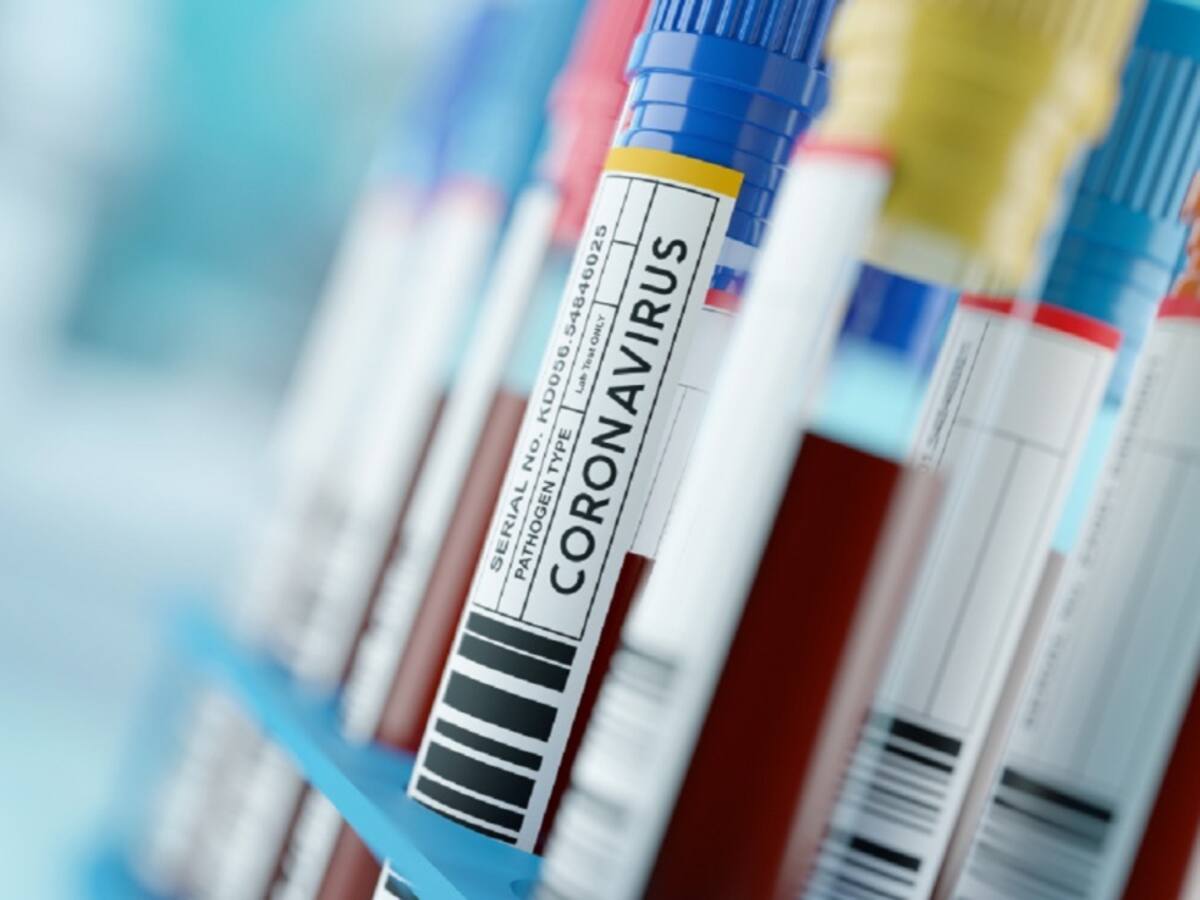 Crece cifra de pacientes con Coronavirus en Norte de Santander