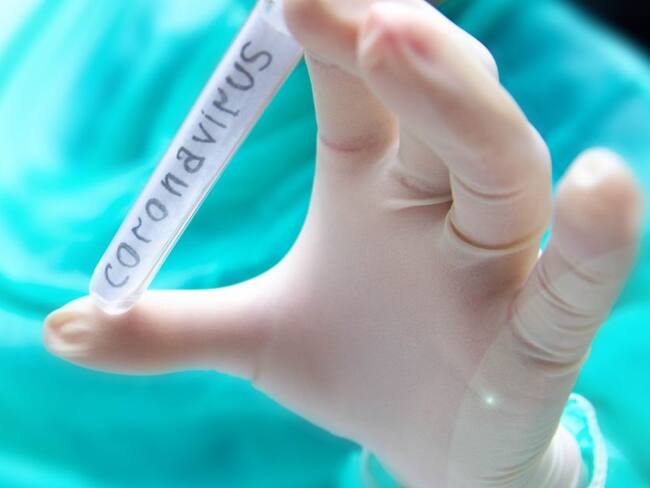 ¿Qué deben saber los colombianos del Coronavirus, cómo prevenirlo?