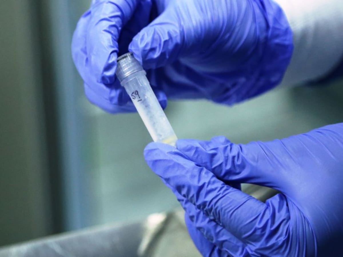 Cartagena registra el primer caso de viruela del mono