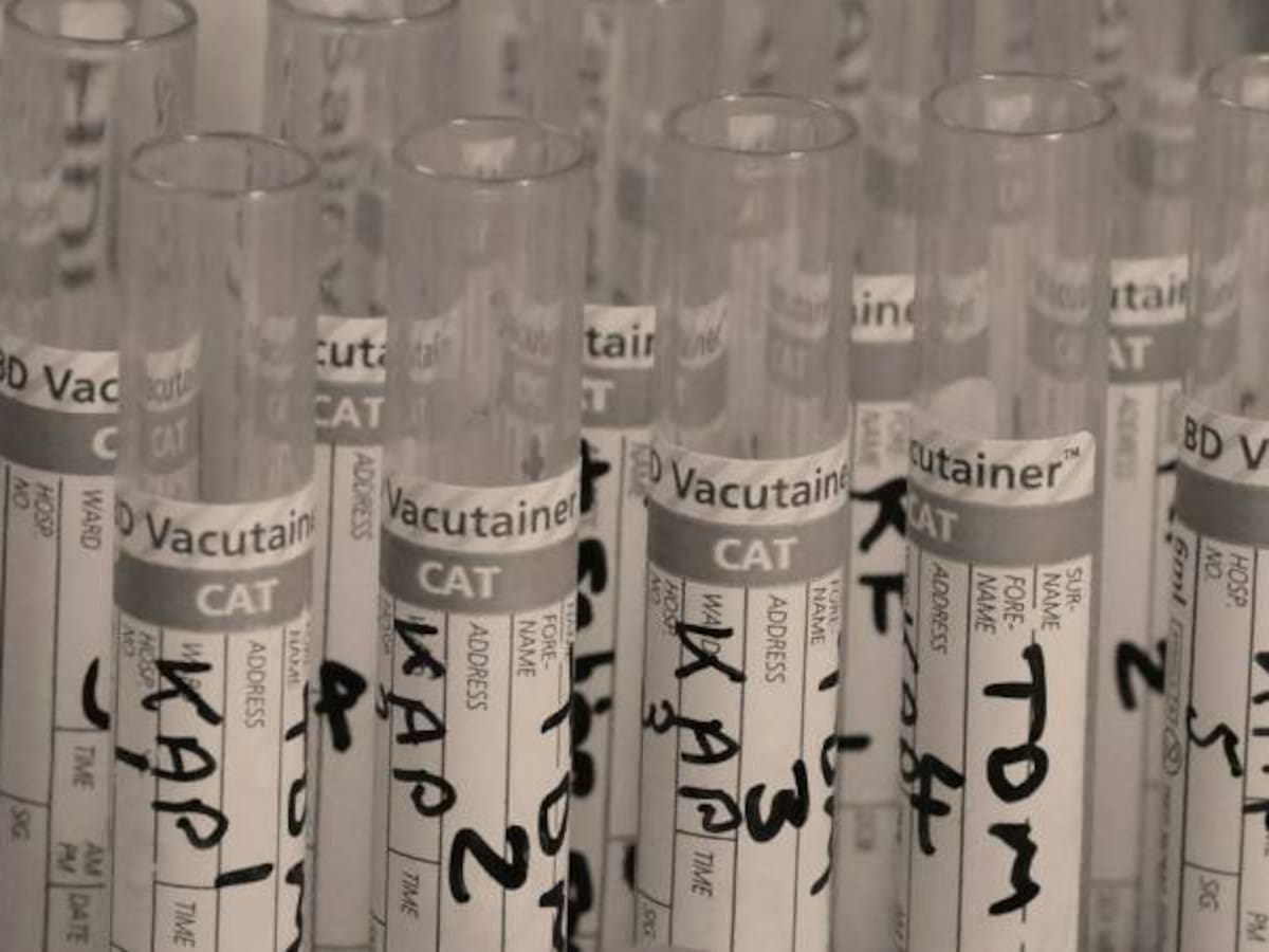 Descubren planta amazónica que ayuda reducir tumores cancerígenos
