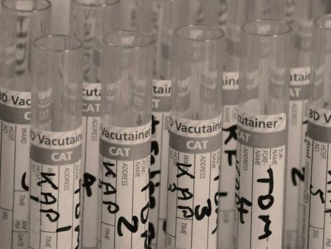 Descubren planta amazónica que ayuda reducir tumores cancerígenos