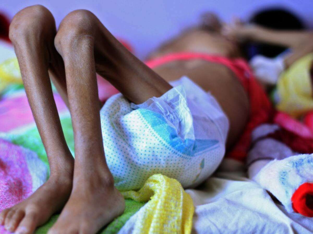 FAO destaca reducción del hambre en Colombia debido a la paz