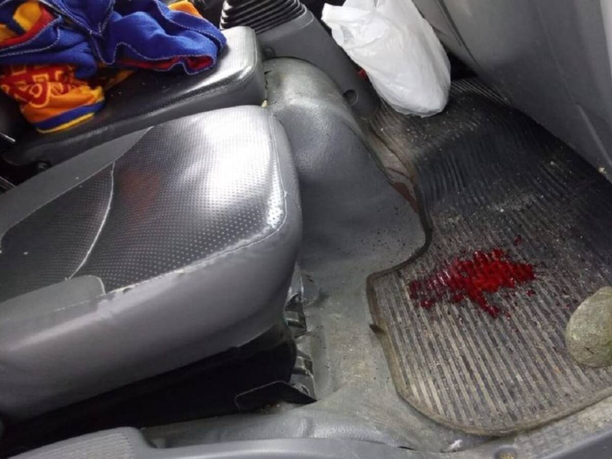 Menor que fue golpeado con una piedra por desconocidos fue dado de alta