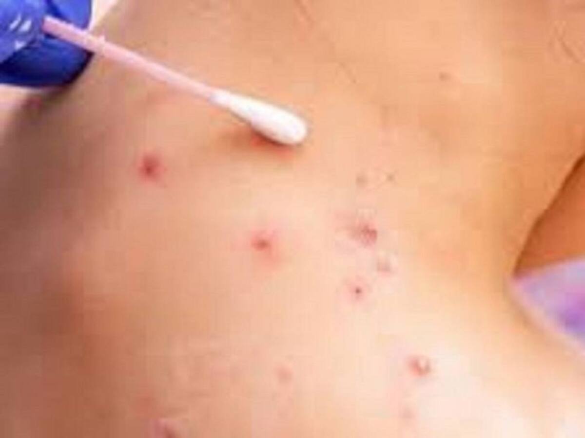 Escuche | El Personaje de la Semana Cali, 21 de agosto de 2022