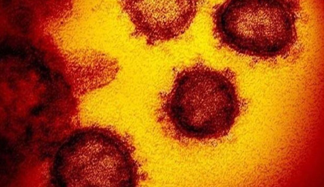 Primera imagen de Ómicrom, la nueva cepa de COVID-19.