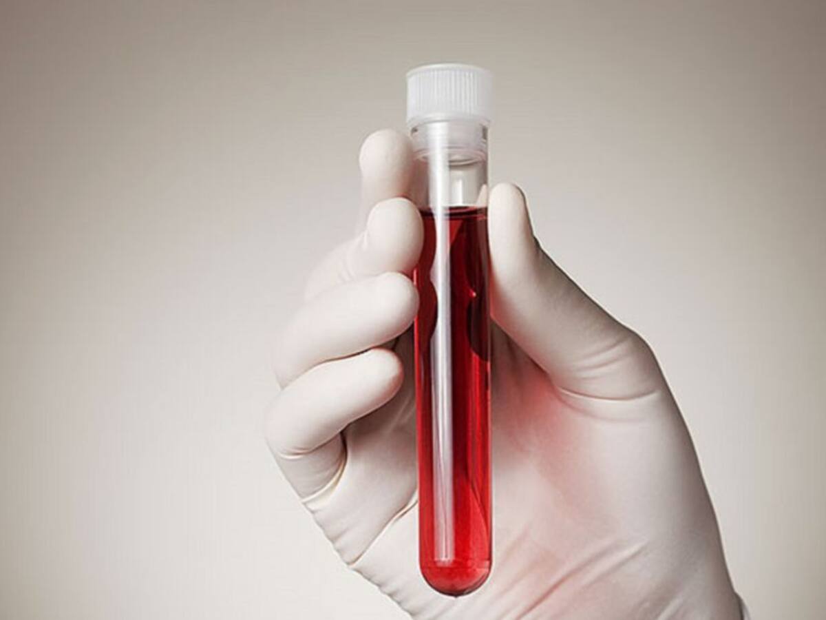 En Santa Marta alertan incremento de casos de VIH en venezolanos