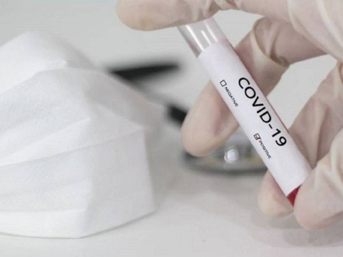 Nivel de contagio de COVID-19 en el Quindío por debajo del 20%