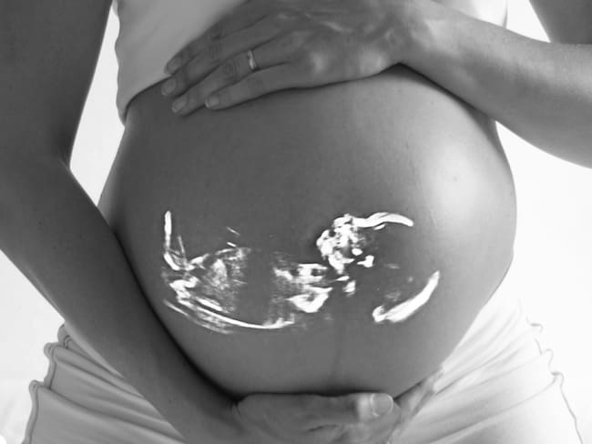 Corte tumbó prohibición para donar tejidos de fetos abortados