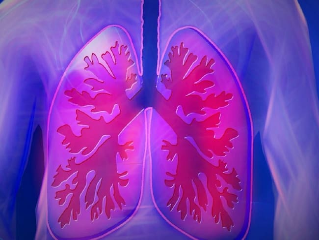 Tecnología colombiana que previene cáncer de pulmón con Inteligencia Artificial