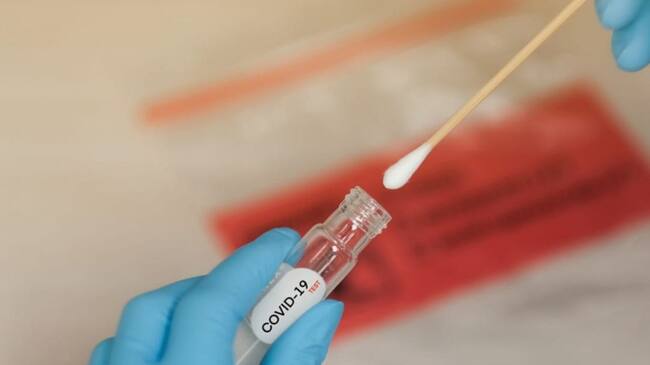 Solo un caso de Covid19 se reportó hoy para el Huila.