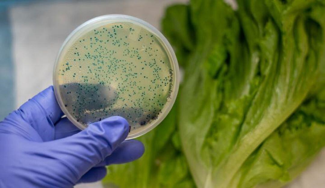 El Huila reporta 88 casos de Escherichia Coli.