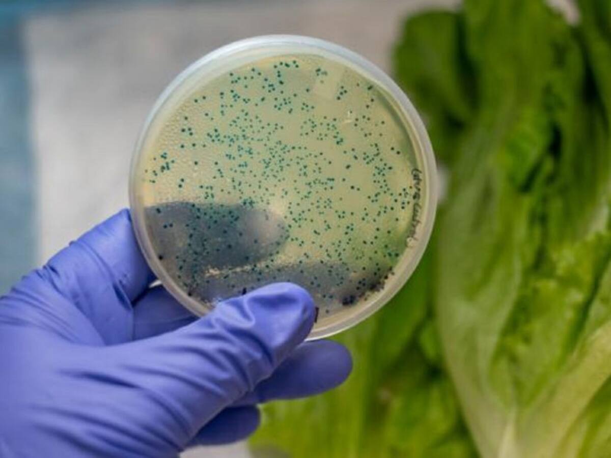 El Huila reporta 88 casos de Escherichia Coli