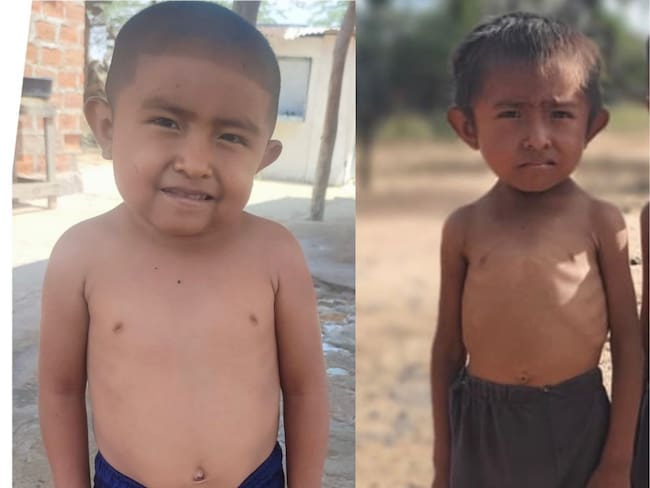 “No quiero volver al hambre”: Wilmer, niño wayúu que lucha contra la desnutrición crónica