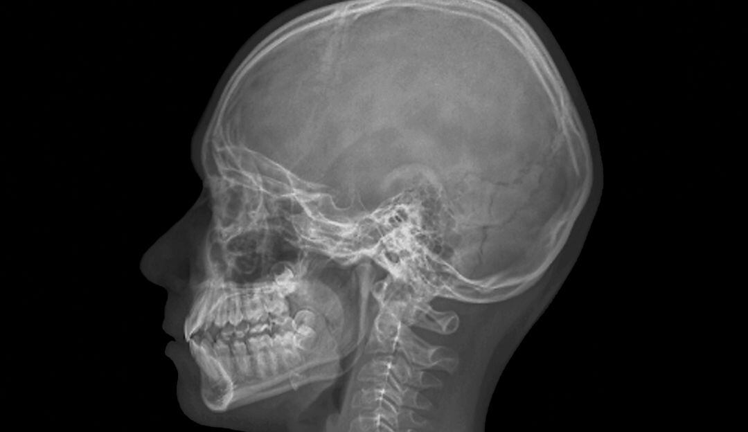 Imagen de referencia