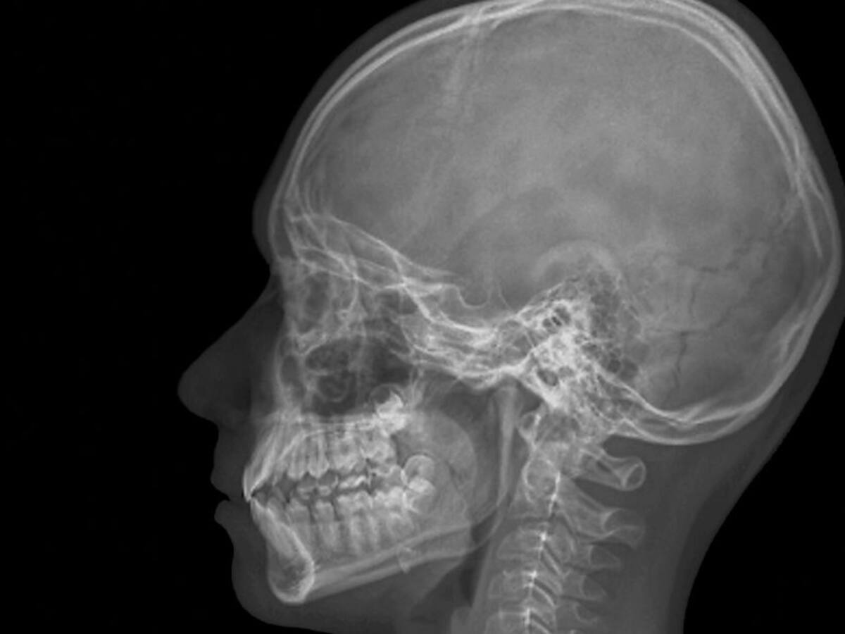 Científicos descubren una "nueva" parte del cuerpo