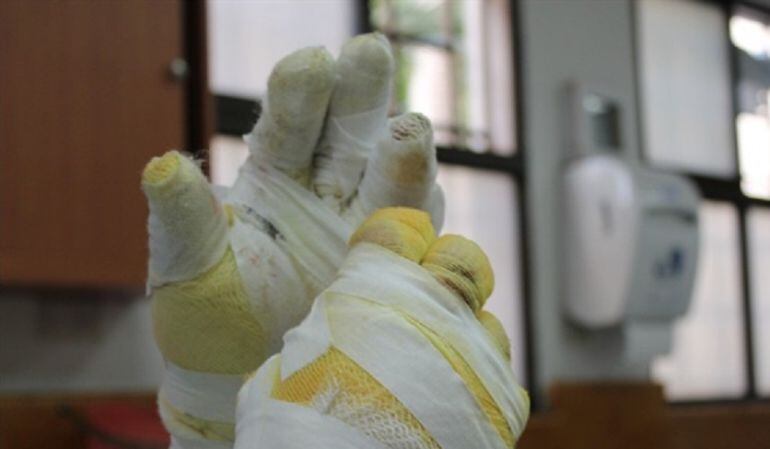 Quemados por pólvora