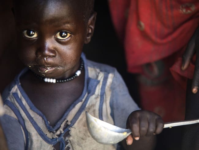 Unos 85.000 niños han muerto de hambre en Yemen en los últimos cuatro años