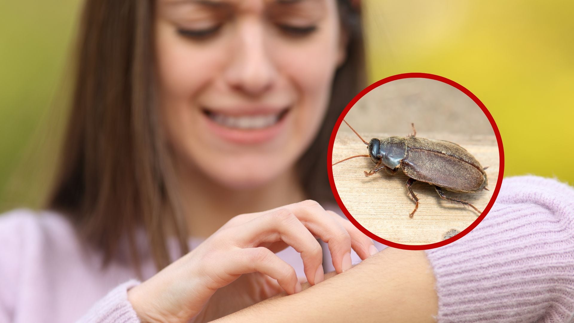 Picadura de cucaracha de agua. Imagen de referencia. Fotos: Getty Images.